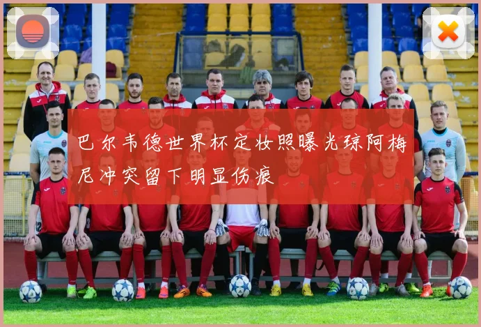 巴尔韦德世界杯定妆照曝光琼阿梅尼冲突留下明显伤痕